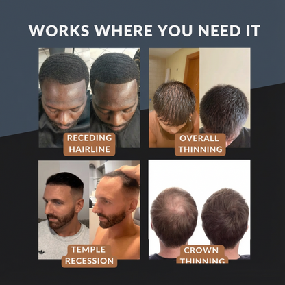 Dexaro™ - Hair Density Powder