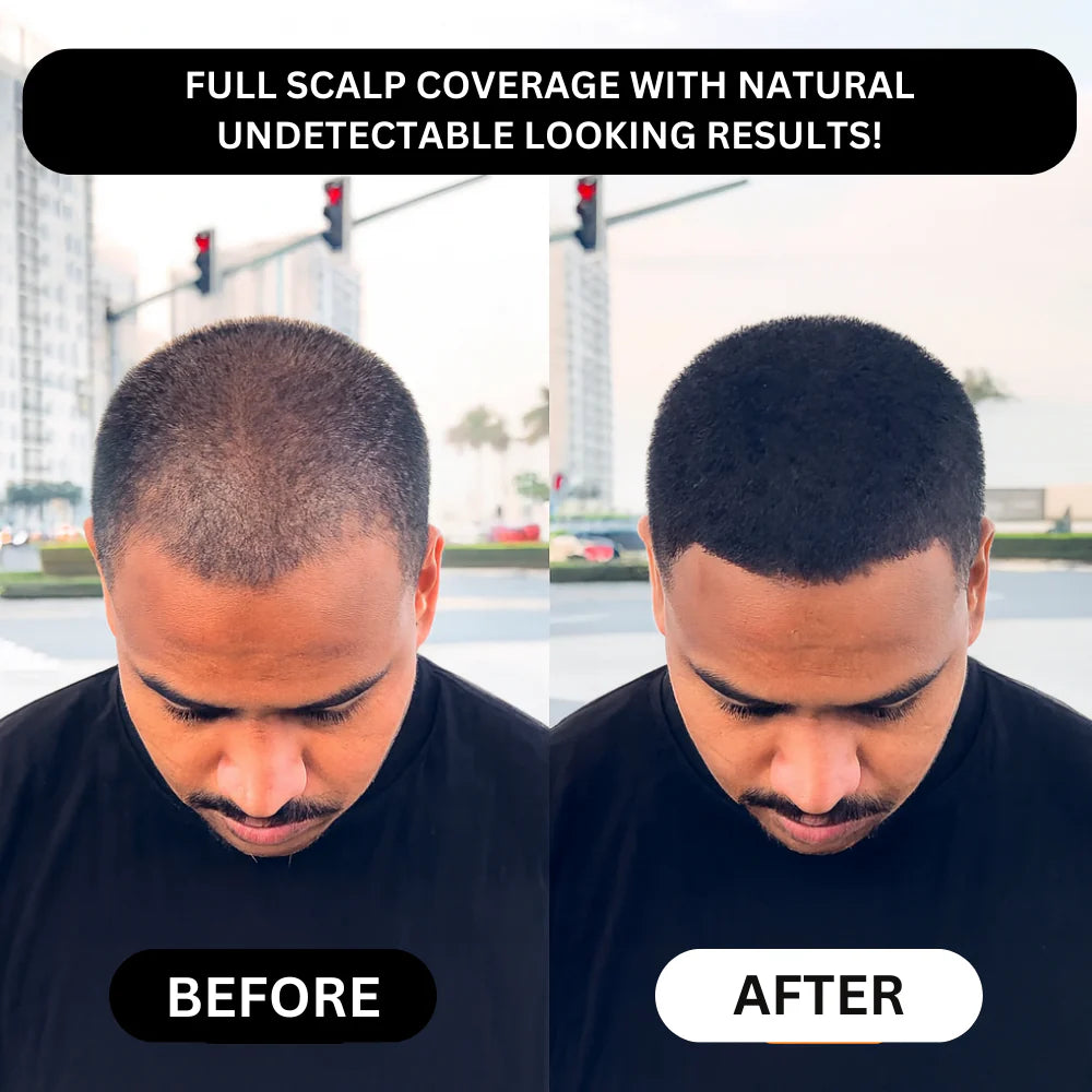 Dexaro™ - Hair Density Powder