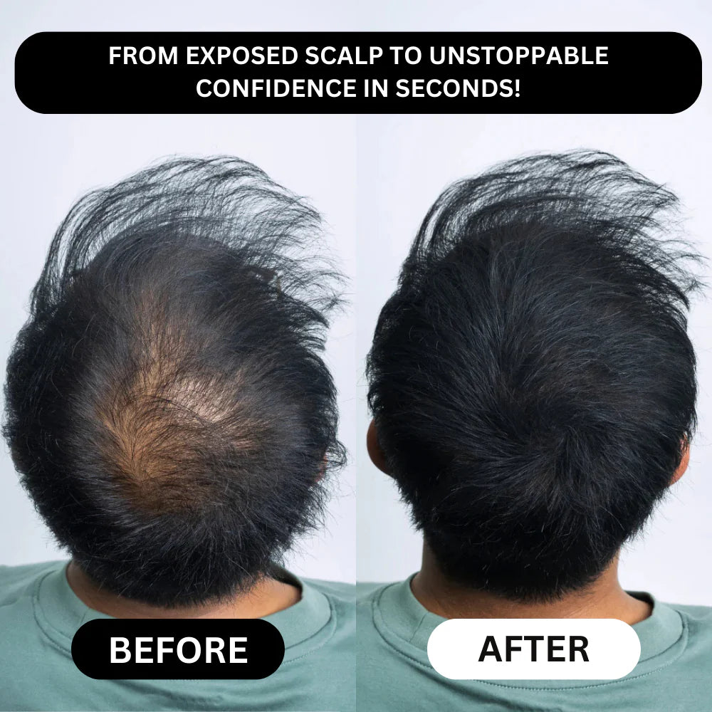 Dexaro™ - Hair Density Powder